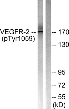 Flk-1/VEGFR2 (phospho Tyr1059) rabbit pAb Antibody