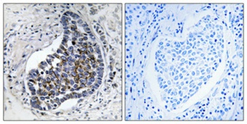 Cytokeratin 8 rabbit pAb Antibody