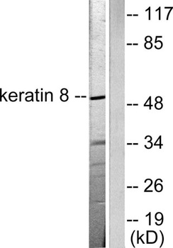 Cytokeratin 8 rabbit pAb Antibody