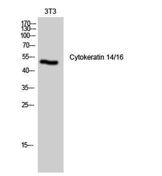 Cytokeratin 14/16 rabbit pAb Antibody