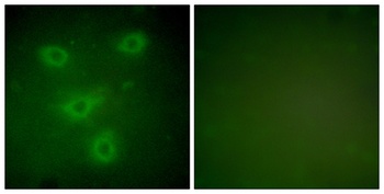 Cytokeratin 14/16 rabbit pAb Antibody