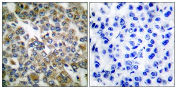 Cytokeratin 14/16 rabbit pAb Antibody