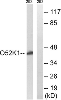 Olfactory receptor 52K1 rabbit pAb Antibody
