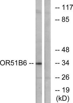 Olfactory receptor 51B6 rabbit pAb Antibody