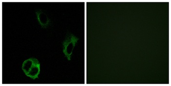 Olfactory receptor 51I1 rabbit pAb Antibody