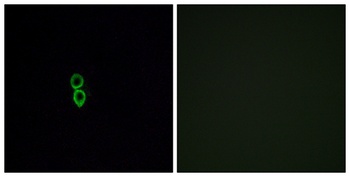 Olfactory receptor 5W2 rabbit pAb Antibody