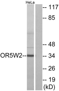 Olfactory receptor 5W2 rabbit pAb Antibody