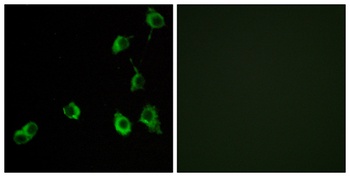 Olfactory receptor 5B12 rabbit pAb Antibody