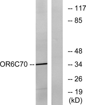 Olfactory receptor 6C70 rabbit pAb Antibody