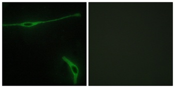 Laminin α-2 rabbit pAb Antibody