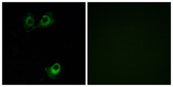 Olfactory receptor 11L1 rabbit pAb Antibody