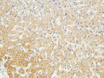 LBP rabbit pAb Antibody