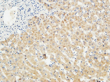 LBP rabbit pAb Antibody