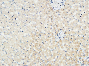 LBP rabbit pAb Antibody