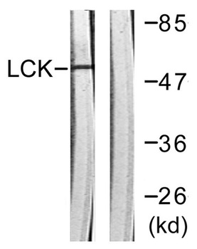 Lck rabbit pAb Antibody