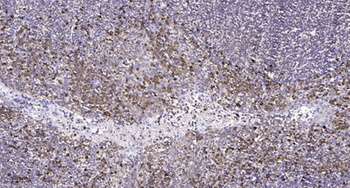 Lck rabbit pAb Antibody