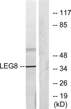 Galectin-8 rabbit pAb Antibody