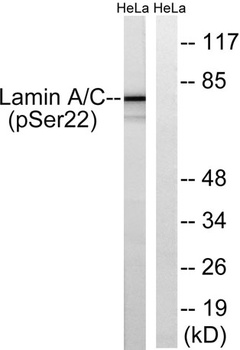 Lamin A/C (phospho Ser22) rabbit pAb Antibody