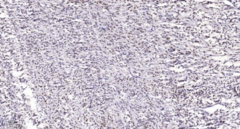 Lamin A/C (phospho Ser22) rabbit pAb Antibody