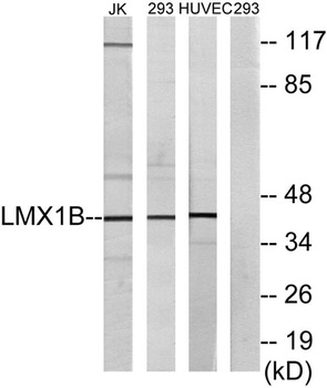 LMX1B rabbit pAb Antibody