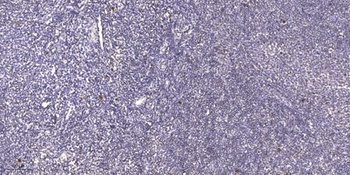 LMX1B rabbit pAb Antibody