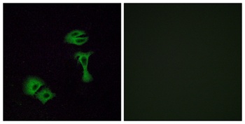 Olfactory receptor 51A2 rabbit pAb Antibody