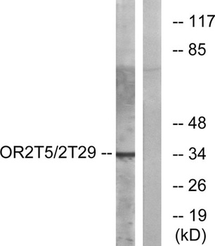 Olfactory receptor 2T5/2T29 rabbit pAb Antibody