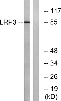 LRP3 rabbit pAb Antibody