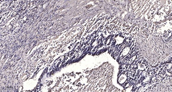 LRP3 rabbit pAb Antibody