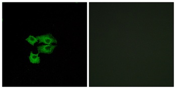 TSA-1 rabbit pAb Antibody