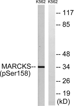 MARCKS (phospho Ser159) rabbit pAb Antibody