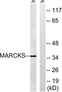 MARCKS rabbit pAb Antibody