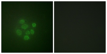 MDM2 (phospho Ser166) rabbit pAb