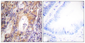 Met (phospho Tyr1003) rabbit pAb