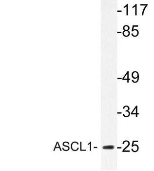 ASCL1 rabbit pAb