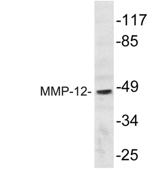MMP-12 rabbit pAb Antibody