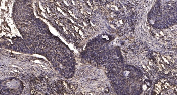 MMP-15 rabbit pAb Antibody
