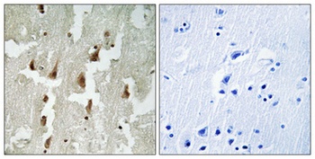 MNDA rabbit pAb Antibody