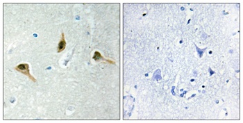 MSH2 rabbit pAb Antibody