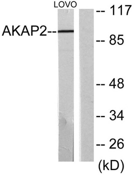 AKAP 2 rabbit pAb Antibody