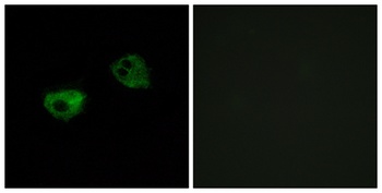 MEL-1A-R rabbit pAb Antibody