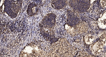 MEL-1A-R rabbit pAb Antibody