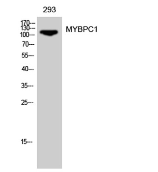 MYBPC1 rabbit pAb Antibody