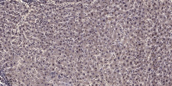 MYBPC1 rabbit pAb Antibody