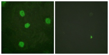 B-Myb (phospho Ser577) rabbit pAb
