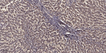 MYLK rabbit pAb Antibody