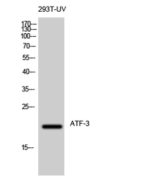 ATF-3 rabbit pAb Antibody