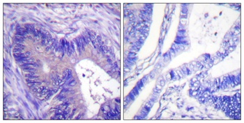 ATP-citrate synthase (phospho Ser455) rabbit pAb