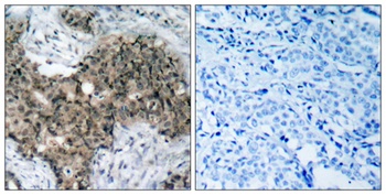 Atm rabbit pAb Antibody
