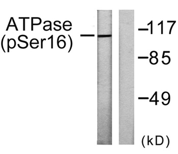 Na+/K+-ATPase α1 (phospho Ser16) rabbit pAb